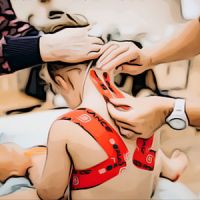 Кинезиотейпирование